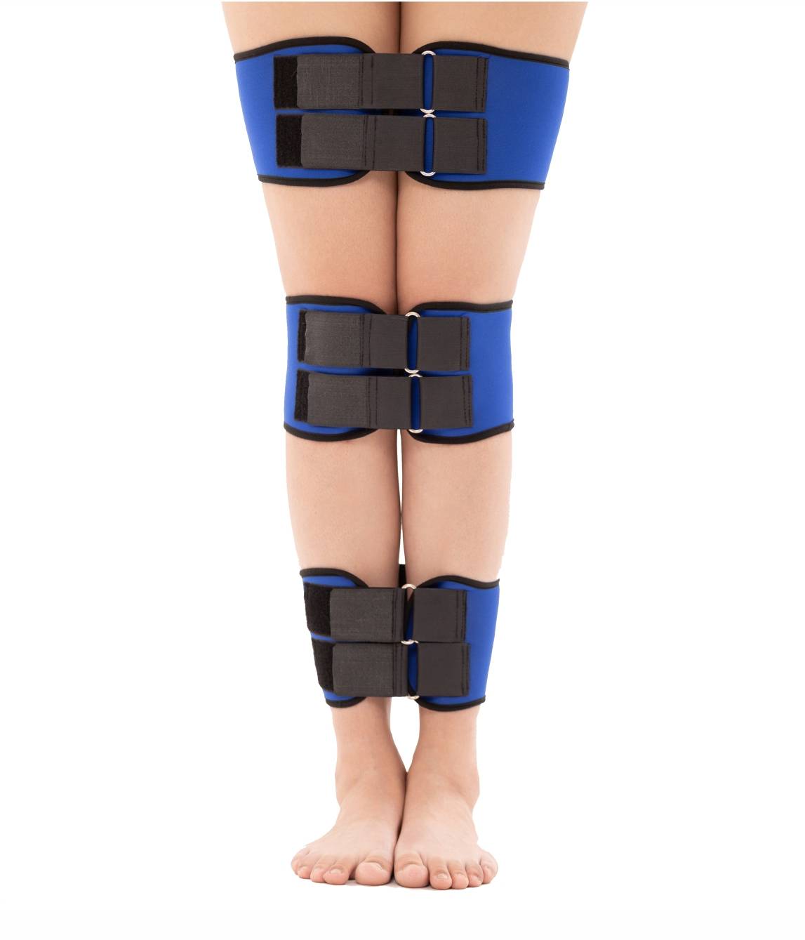 Orthopedic belts for leg alignment