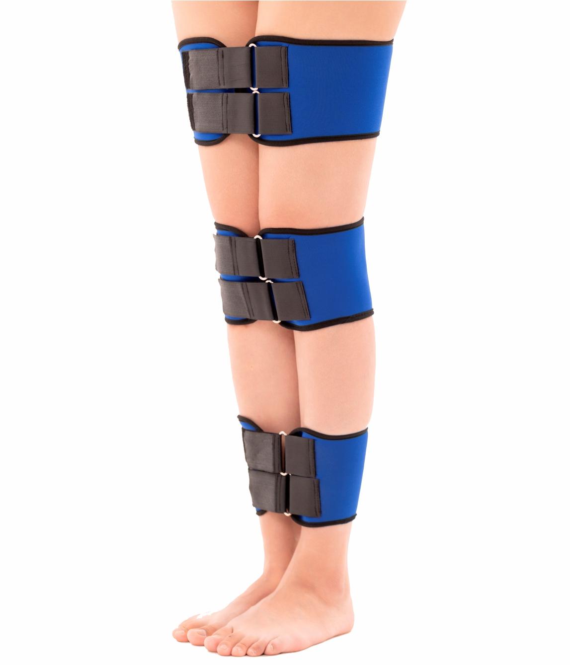 Orthopedic belts for leg alignment
